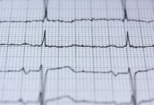 quantum pulse drives success transformations